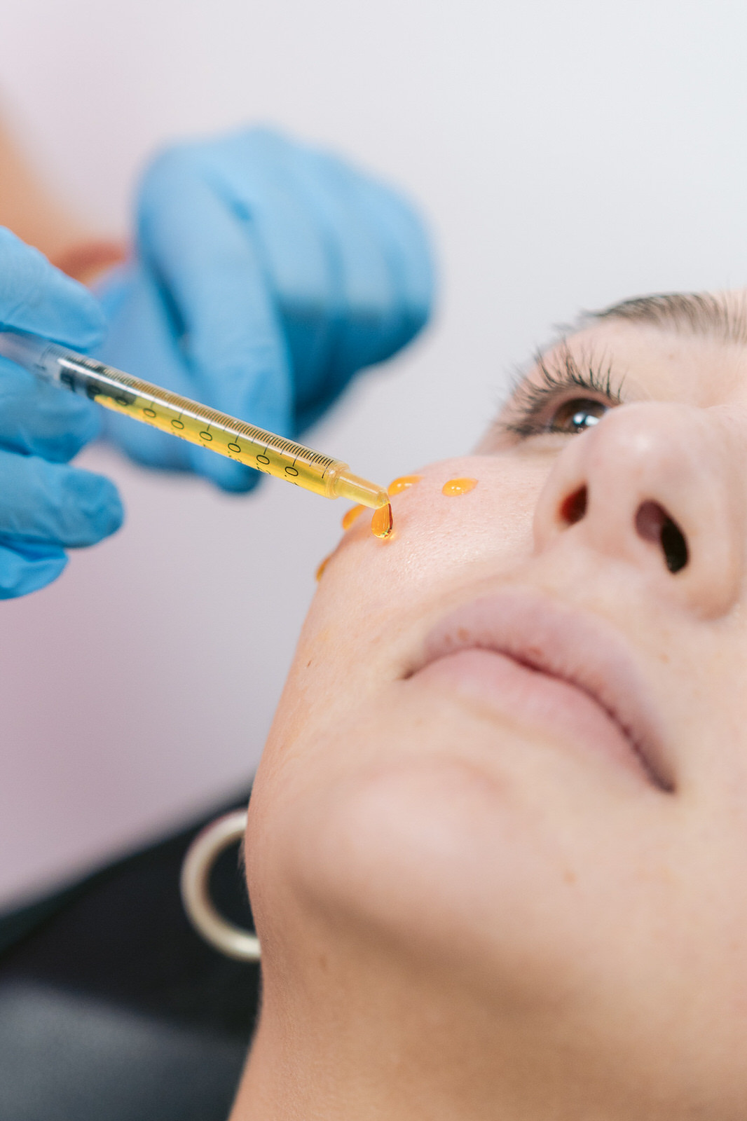 CDM Medical — Purasomes aplicacion nariz primer plano